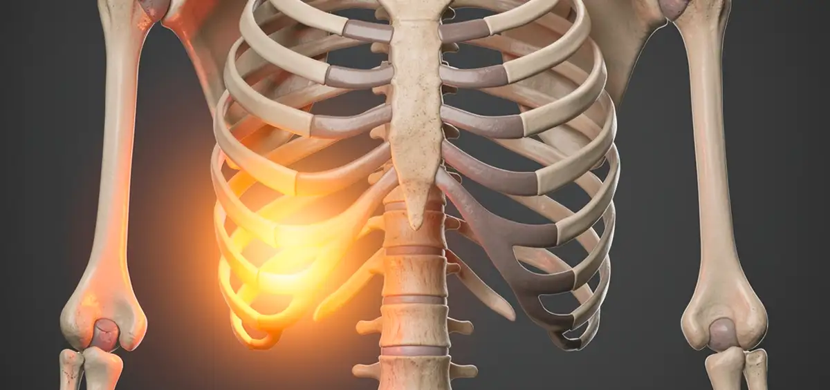 KI-generierte Darstellung eines Skeletts: Brustkorb mit schmerzenden Rippen